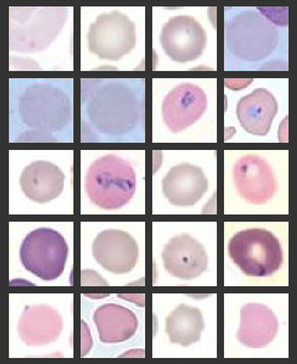 Screen Capture from Microscope