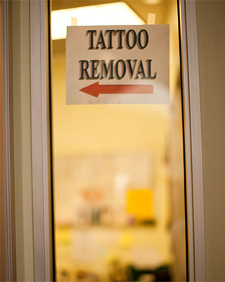 Sign for Tattoo Removal